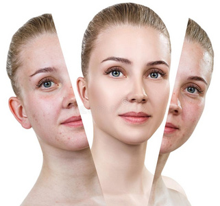 问题和干净的皮肤女人和问题皮.照片