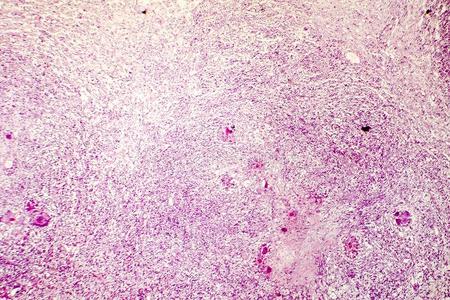 细胞的坏死图片