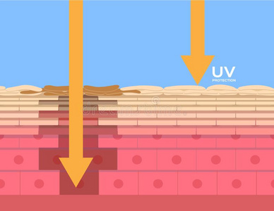 umbilicalvein脐静脉保护,紫外的比较