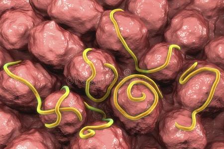 蠕虫线虫蛲虫属照片
