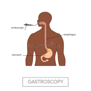 矢量胃镜检查法观念