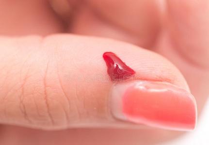 手指血图片