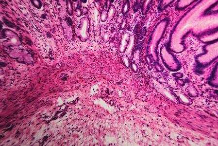 细胞显微镜的幽门的分开胃