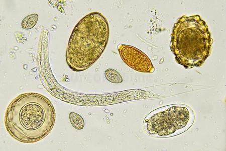 粪类圆线虫卵图片