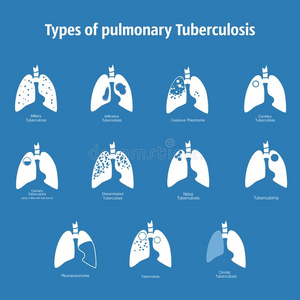 类型关于肺结核.矢量轮廓医学的说明关于