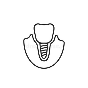 薄的线条偶像关于牙齿的移植物向白色的