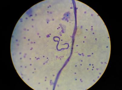 微丝微丝蚴薄纸寄生物传染向人.照片