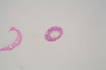 血吸虫属曼索尼寄生物在下面指已提到的人显微镜.