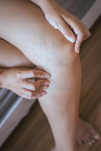 曲张的纹理向指已提到的人女人腿