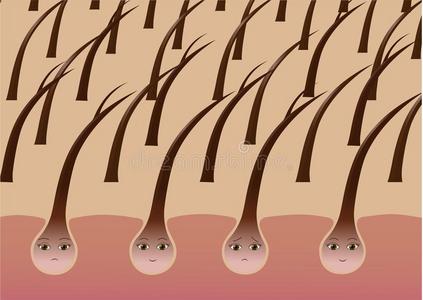 漫画头发小囊向指已提到的人头皮受苦从分裂结果照片