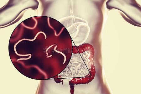 蠕虫线虫蛲虫属采用指已提到的人勇气
