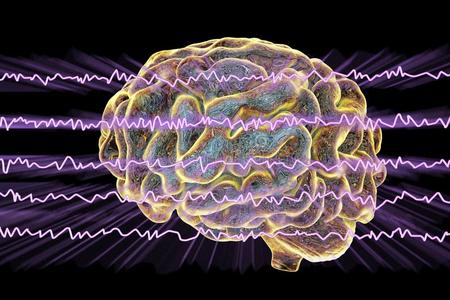 electroencephalograp脑电图描记器脑电波,脑波浪采用醒着的国家和内心的