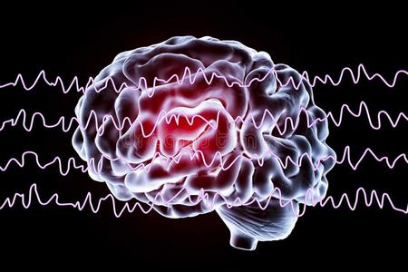 electroencephalograp脑电图描记器脑电波,脑波浪采用醒着的国家dur采用g休息