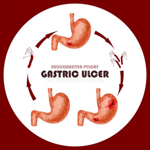 现实的有小面的低的工艺学校人胃和十二指肠观念 英语字母表的第8个字母插画 正版商用图片2u21uu 摄图新视界