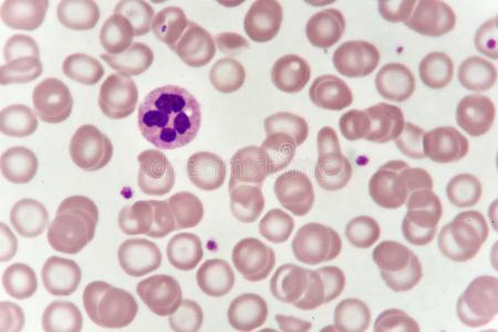 嗜中性的细胞采用血涂抹