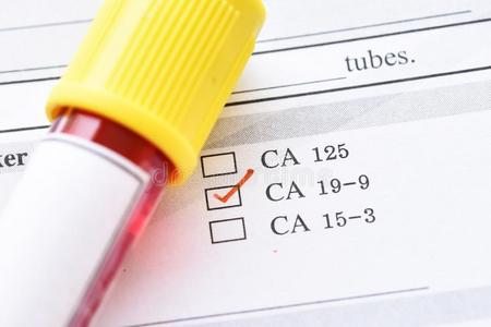 血样品为Cana加拿大19-9试验