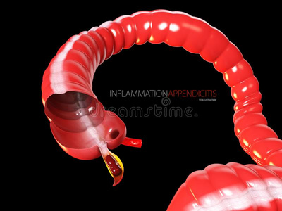 3英语字母表中的第四个字母说明关于阑尾炎观念,人肠解剖