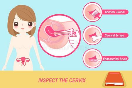 妇科检查漫画女人和检查指已提到的人子宫颈照片
