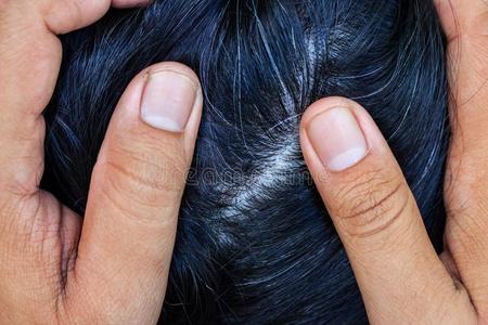 女根女人给看她灰色头发根照片