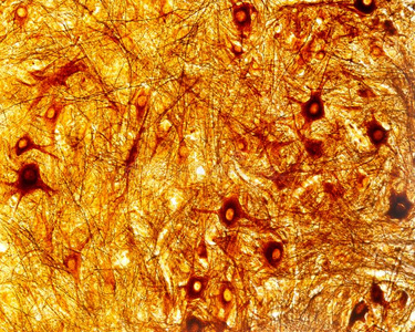 影像解剖学多极神经元.脊柱的绳照片