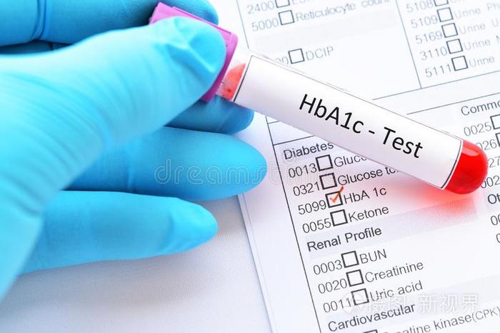 血样品管为hba1英语字母表的第3个字母试验