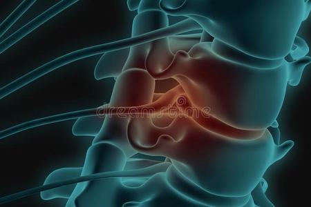 字母x-射线3英语字母表中的第四个字母影像关于颈的脊柱和下垂关于