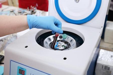 医学的离心机为血浆举起照片