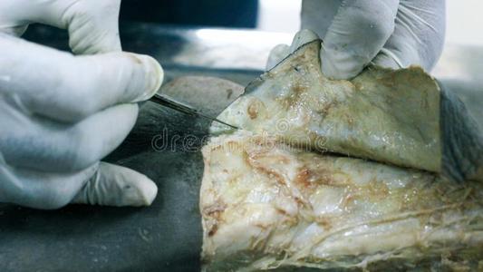 太平间的脚图片