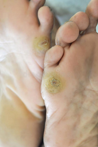 老女人的脚图片