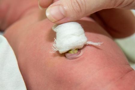 关在上面关于脐新生的婴儿男孩.关在上面脐带的绳.照片