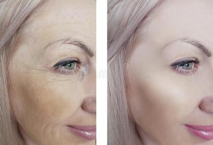 皮肤皱纹皱纹皱纹图片-皮肤皱纹皱纹皱纹素材-皮肤皱纹皱纹皱纹插画