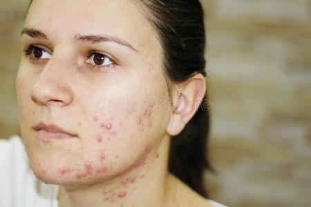 身上起红疙瘩不痒图片