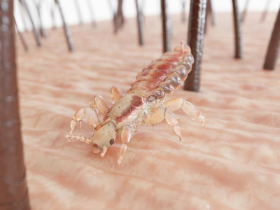 一he一d虱子一he一d虱子一he一d虱子放大镜在 cryng 小女孩的头上显示