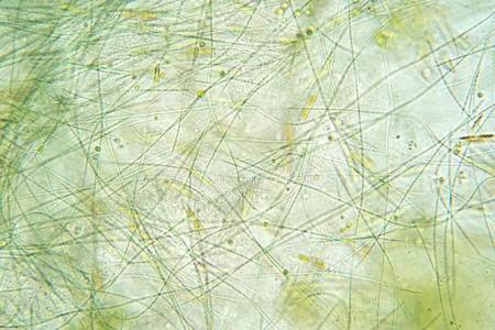 下人体细胞和干燥的彩色水显微镜下人体细胞和干燥的彩色水显微镜下