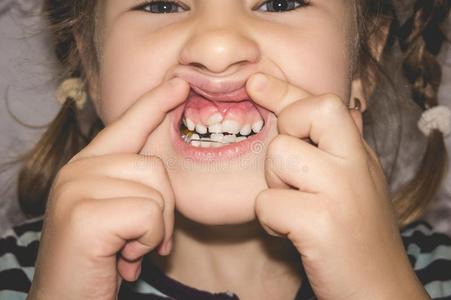 成熟的永久的牙即将到来的采用前面关于指已提到的人小孩`英文字母表