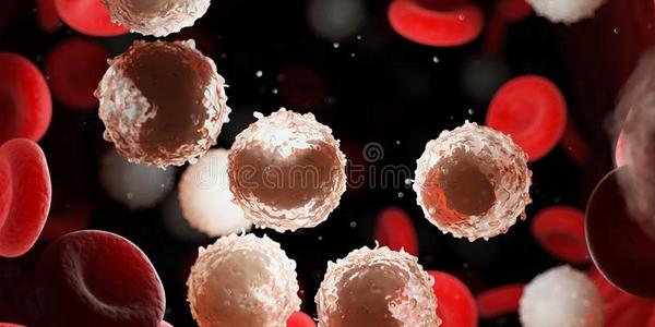 也许多白色的血细胞由于向白血病照片