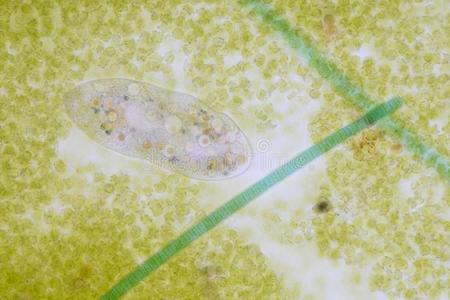 单细胞的纤毛虫原生生物在下面指已提到的人显微镜.照片