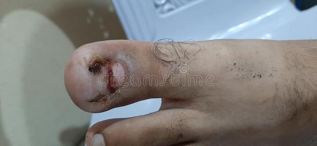 受伤的身体图片