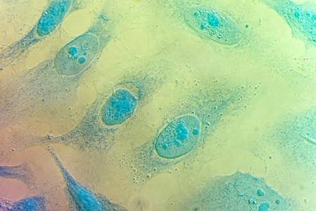 勒颈无花果树henriettalacksstrainof癌症细胞海拉癌细胞株颈的癌症