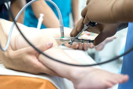 膀胱镜检查图片