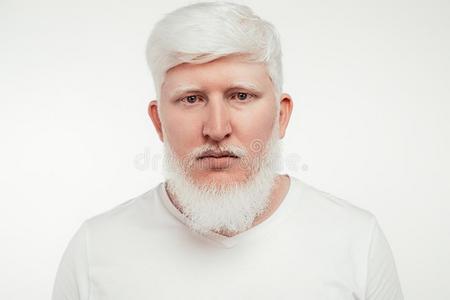 白化病者男人向白色的背景照片