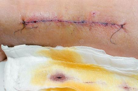 被缝合的甜蜜图片