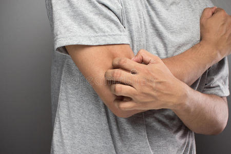 皮炎症指已提到的人男人有问题皮,过敏性反应,易经皮照片