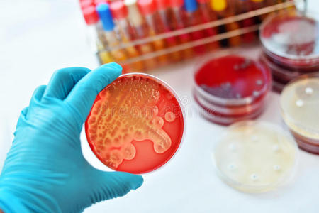 培养涂抹,念珠菌病,阴道炎,衣原体革兰阴性菌细菌的主要形式性传播