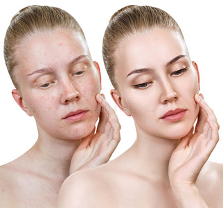 女人和问题皮.照片