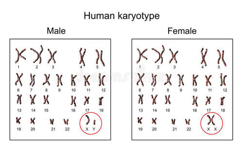 3x染色体女孩图片图片