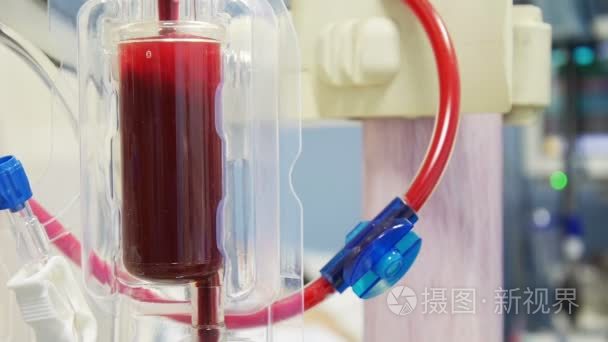 透析机血充视频