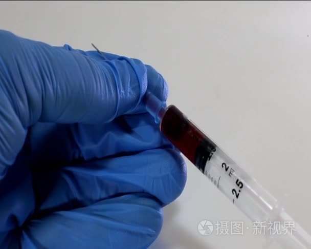 医生用手套和注射器与血液样本视频