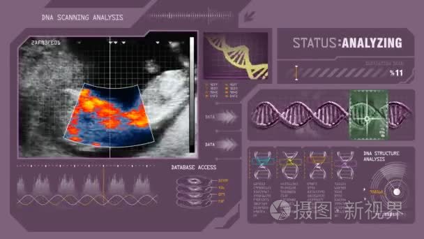 胎儿在子宫中的扫描视频