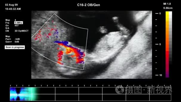 医学超声扫描的人类胚胎视频